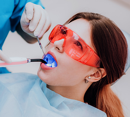 Root Canals Services